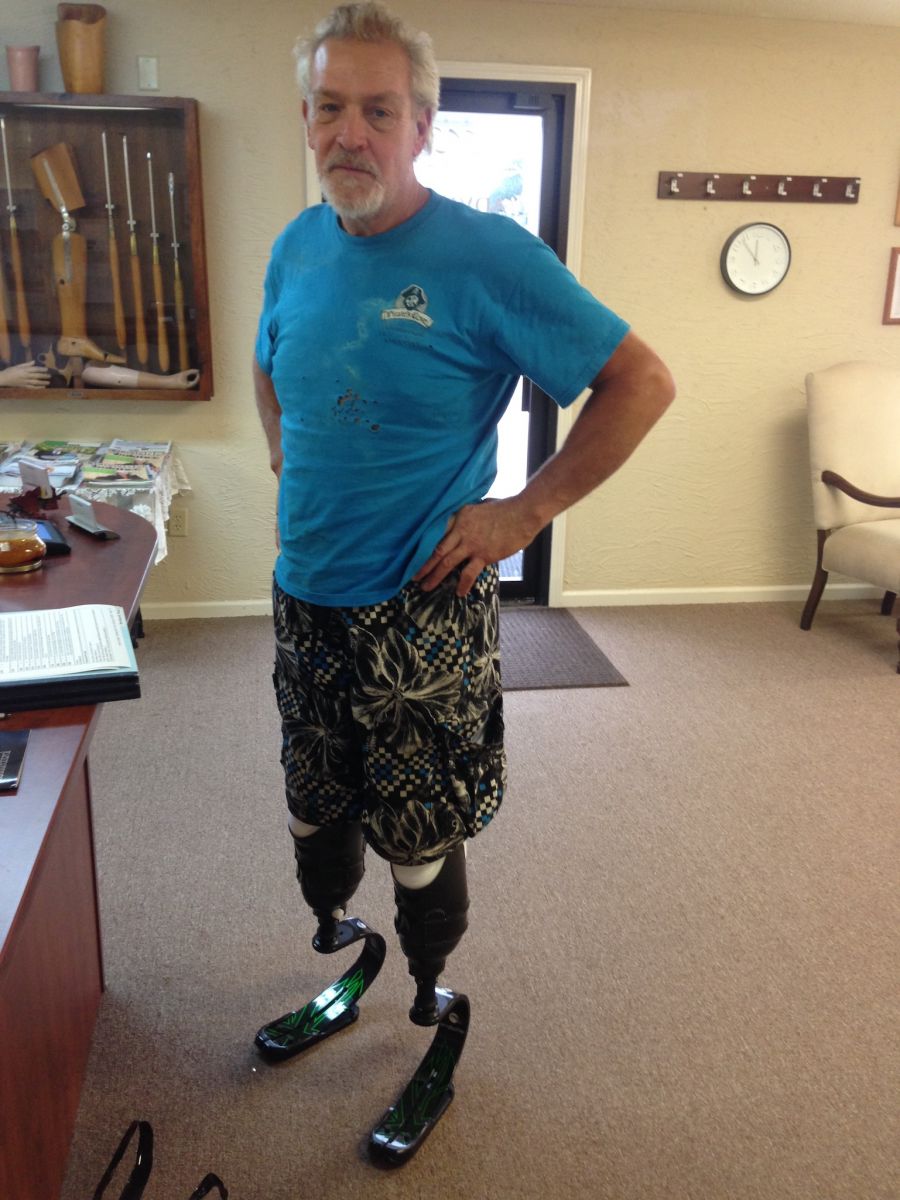 Image Gallery - Prosthetic & Orthotic Services | Arkansas